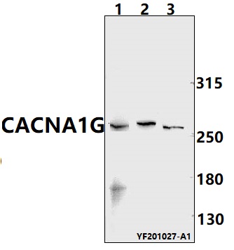 a02645 cacna1g primary antiboties wb testing 1