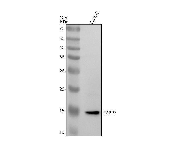 Western blot analysis of FABP7 using anti-FABP7 antibody (A02646-4)