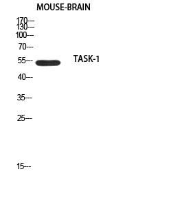 a02648 1 kcnk3 primary antibodyes wb testing 1
