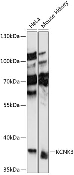 a02648 kcnk3 primary antiboties wb testing 1