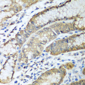 Immunohistochemistry of paraffin-embedded human esophagus using ADH1C antibody at dilution of 1:100 (40x lens)