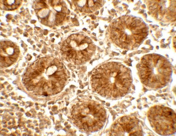 Immunohistochemistry of IFIT1 in human small intestine tissue with IFIT1 antibody at 5 μg/mL