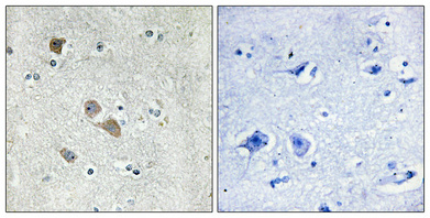 Immunohistochemical analysis of paraffin-embedded Human brain