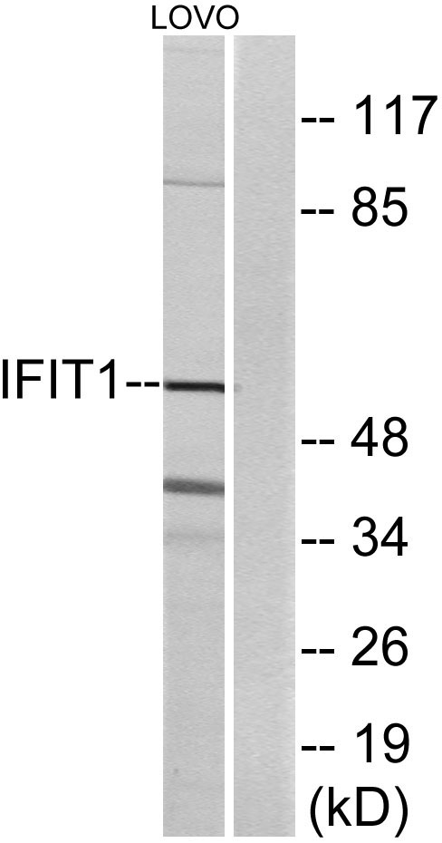 Western blot analysis of lysates from LOVO cells, using IFIT1 Antibody