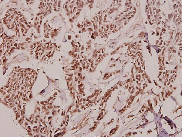 a02653 1 tcof1 primary antiboties ihc testing 2