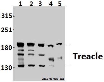 a02653 1 tcof1 primary antiboties wb testing 1