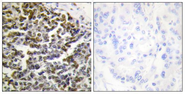 a02653 tcof1 primary antibodies ihc testing 1