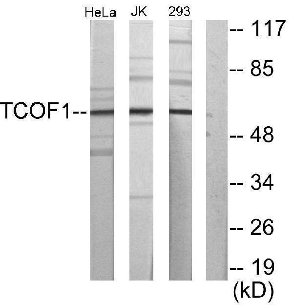 a02653 tcof1 primary antibodies wb testing 2