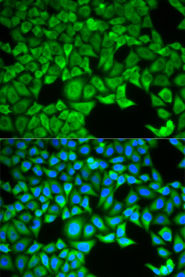 Immunohistochemistry of paraffin-embedded mouse kidney using SLC3A1 Rabbit pAb  at dilution of 1:200 