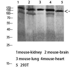 Western blot analysis of 293T lysate, antibody was diluted at 1000