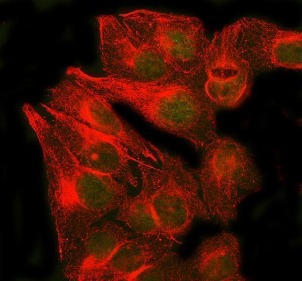 a02658 2 rad51b primary antibodies if testing 2