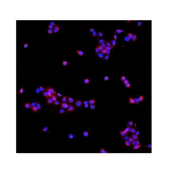 a02659 1 pde6b primary antibodies if testing 5