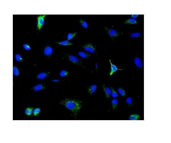 a02659 1 pde6b primary antibodies if testing 6