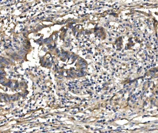  IHC analysis of PDE6 beta/PDE6B using anti-PDE6 beta/PDE6B antibody (A02659-1)