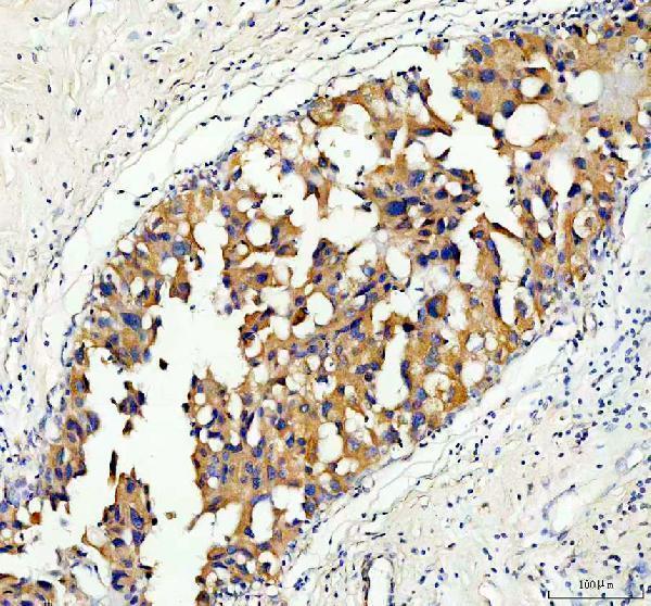  IHC analysis of Serine racemase/SRR using anti-Serine racemase/SRR antibody (A02660-2)