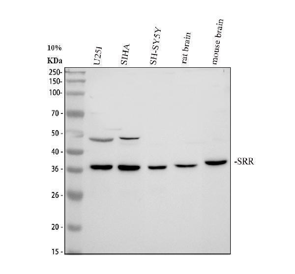  Western blot analysis of Serine racemase/SRR using anti-Serine racemase/SRR antibody (A02660-2)