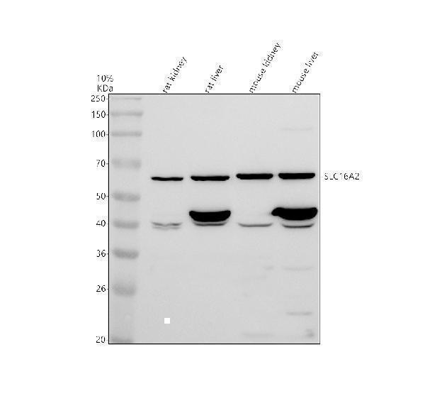 Western blot analysis of SLC16A2 using anti-SLC16A2 antibody (A02662-2)