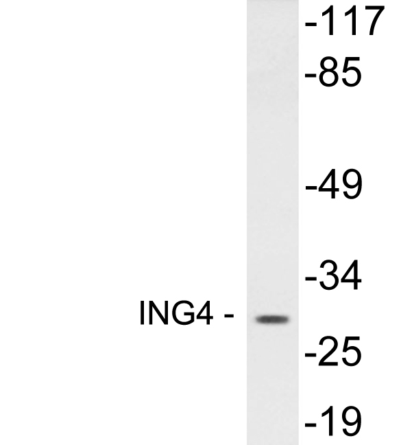 Western blot analysis of lysates from 293 cells, using ING4 antibody