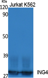 Western Blot analysis of extracts from Jurkat, K562 cells, using ING4 Polyclonal Antibody