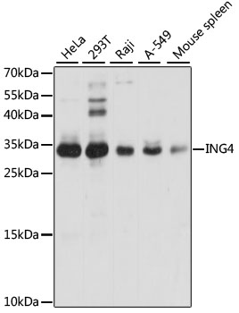 Western blot analysis of extracts of various cell lines, using ING4 antibody  at 1:1000 dilution