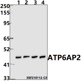 a02665 1 atp6ap2 primary antiboties wb testing 1