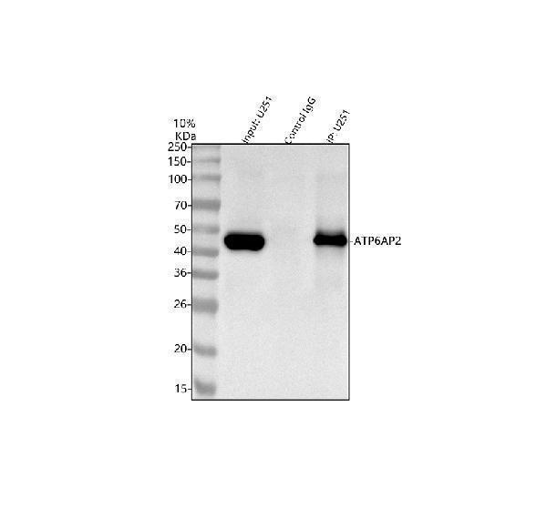 a02665 3 atp6ap2 primary antibodies ip testing 4