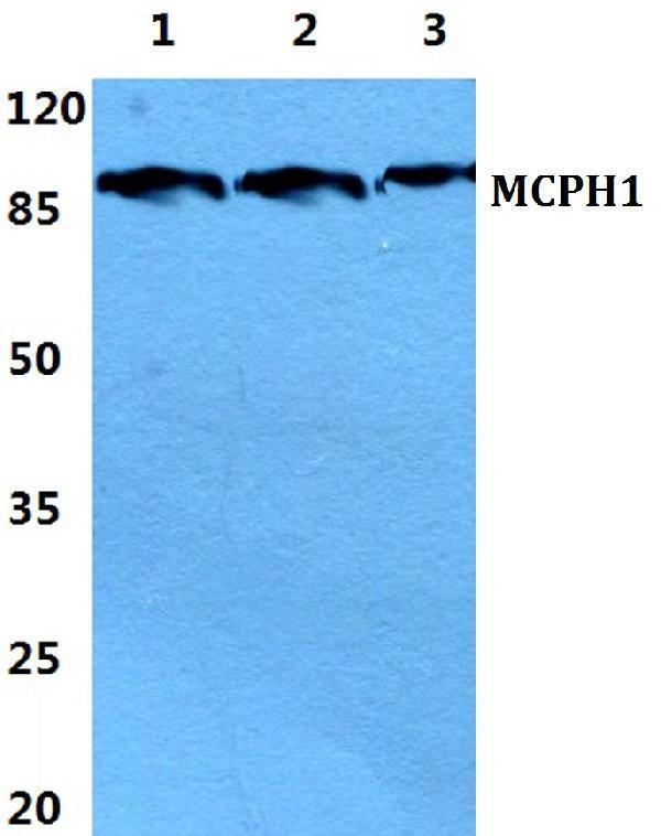 a02666 1 mcph1 primary antiboties wb testing 1
