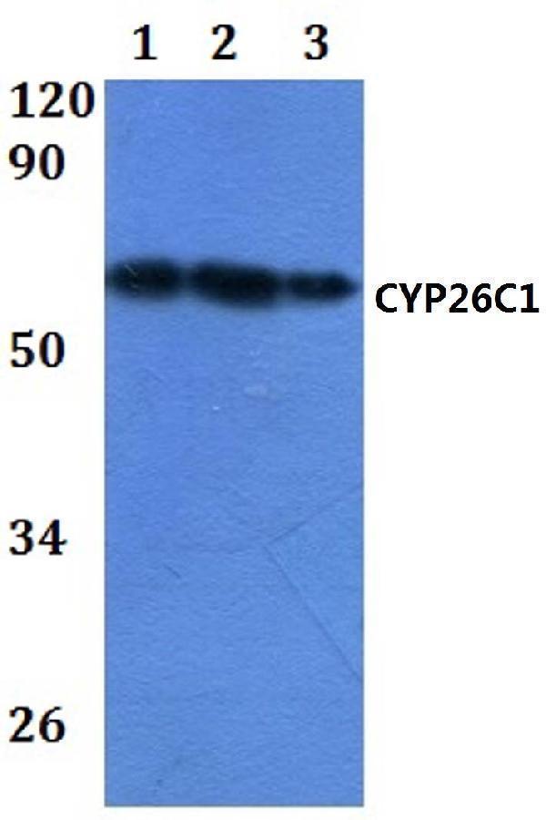a02667 1 cyp26c1 primary antiboties wb testing 1