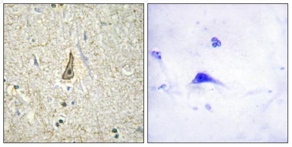 a02667 2 cyp26c1 primary antibodies ihc testing 1