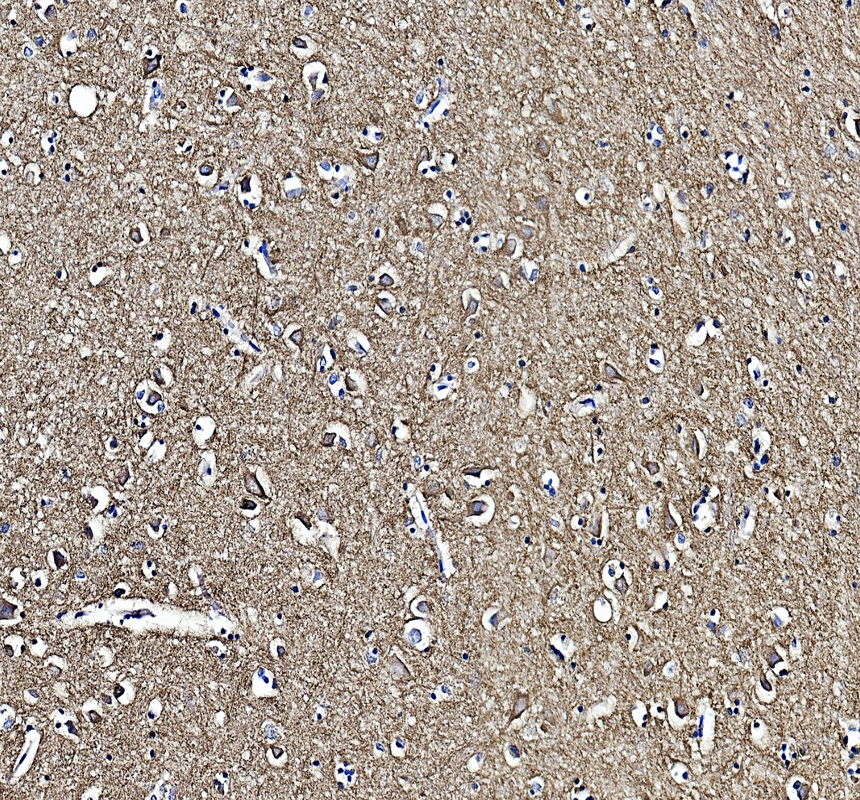 IHC analysis of ATP2B1 using anti-ATP2B1 antibody (A02669-1)