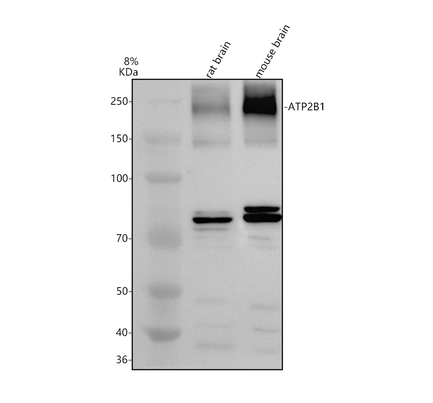 Western blot analysis of ATP2B1 using anti-ATP2B1 antibody (A02669-1)