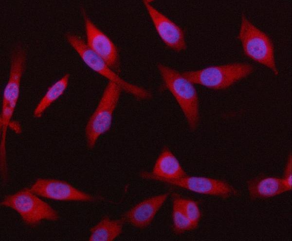  IF analysis of HRD1/SYVN1 using anti-HRD1/SYVN1 antibody (A02670-3)