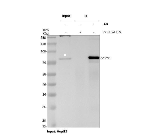 Immunoprecipitating (IP) HRD1/SYVN1 in HepG2 whole cell lysate