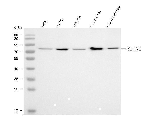  Western blot analysis of HRD1/SYVN1 using anti-HRD1/SYVN1 antibody (A02670-3)