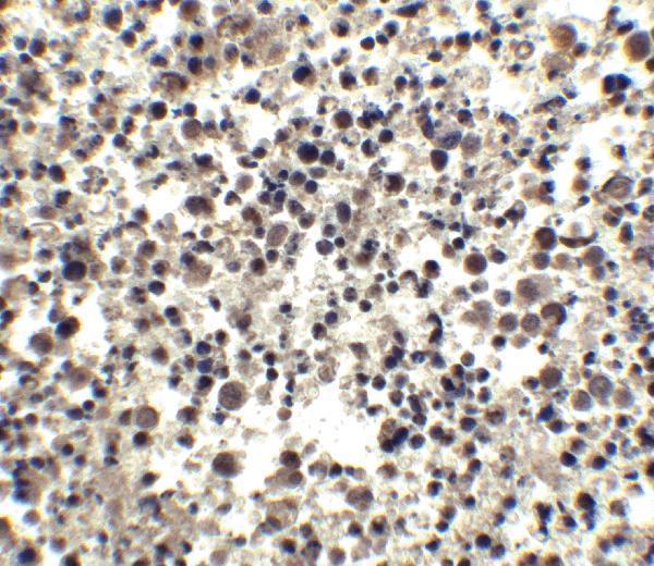 a02671 1 cidea primary antibodies ihc testing 4