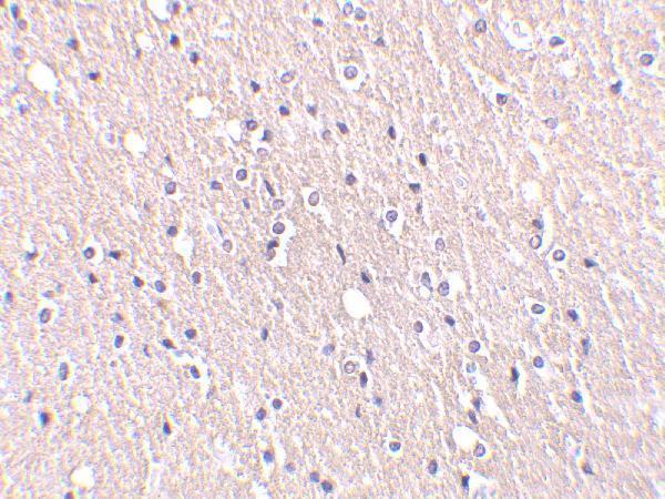 a02671 cidea primary antibodies ihc testing 2