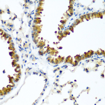 Immunohistochemistry of paraffin-embedded human placenta using TAZ Rabbit pAb  at dilution of 1:50 