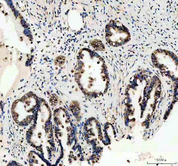 IHC analysis of WWTR1 using anti-WWTR1 antibody (A02672-2)