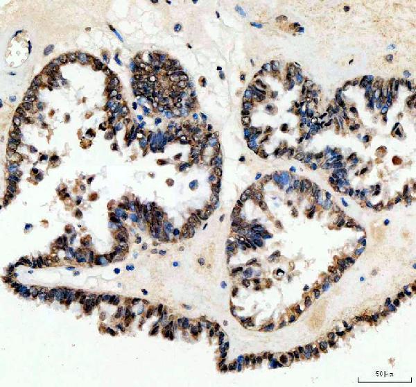 IHC analysis of WWTR1 using anti-WWTR1 antibody (A02672-2)