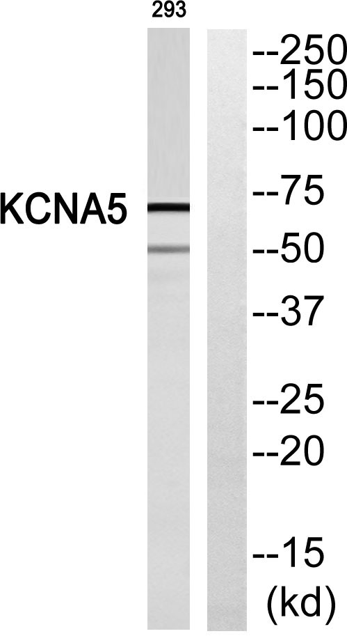 Western blot analysis of KCNA5 Antibody