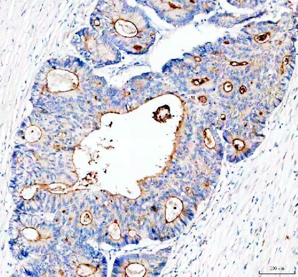 a02674 2 muc13 primary antibodies ihc testing 1