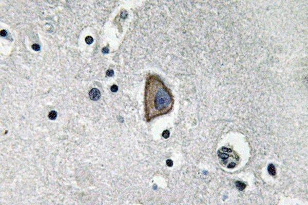 Immunohistochemistry (IHC) analyzes of CD3-ε (D71) pAb in paraffin-embedded human brain tissue
