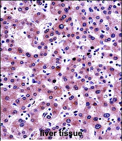 a02676 1 anti nnmt antibody center ihc p testing 2