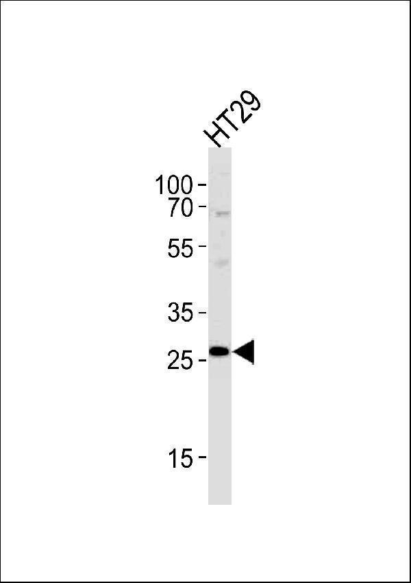 a02676 1 anti nnmt antibody center wb testing 1
