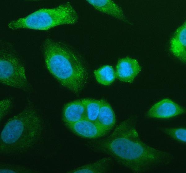 IF analysis of NNMT using anti-NNMT antibody (A02676-2)