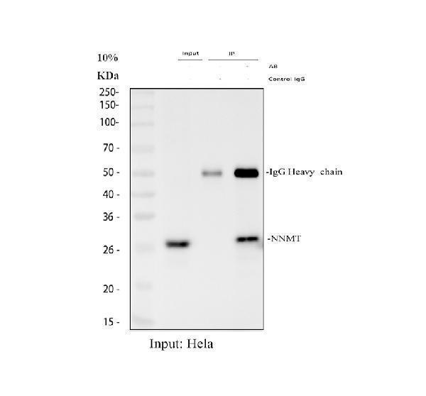 Immunoprecipitating (IP) NNMT in Hela whole cell lysate