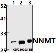 Western blot (WB) analysis of NNMT pAb at 1:1000 dilution
Lane1:The liver tissue lysate of Mouse(40ug)
Lane2:HepG2 whole cell lysate(40ug)
Lane3:SK-OVCAR3 whole cell lysate(40ug)