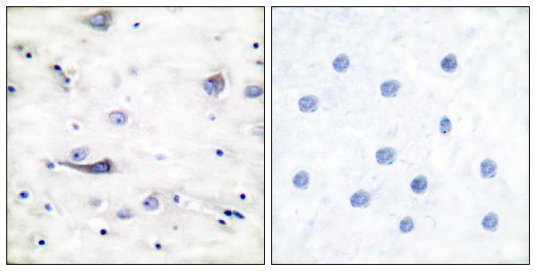 Immunohistochemistry analysis of paraffin-embedded human brain, using GluR1 (Phospho-Ser863) Antibody