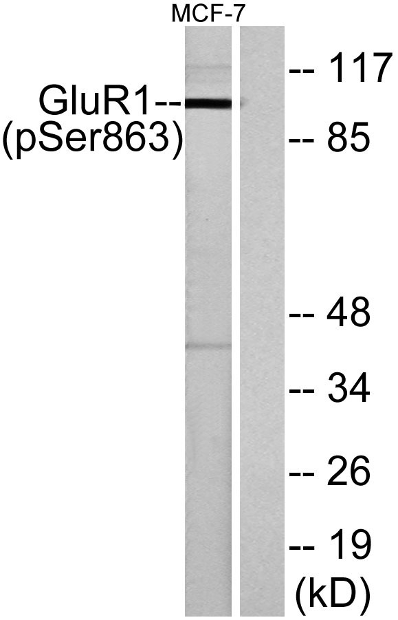 Western blot analysis of lysates from MCF-7 cells, using GluR1 (Phospho-Ser863) Antibody