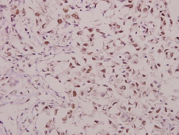 a02677s863 gria1 primary antiboties ihc testing 2